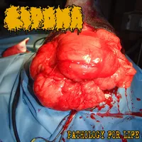 Pathology for Life - Lipoma