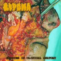 Studies in Clinical Anatomy - Lipoma