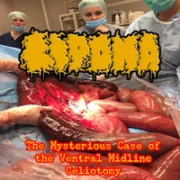 The Mysterious Case of the Ventral Midline Celiotomy - Lipoma