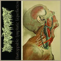 Unstoppable Lymphatic Liquefaction - Pharmacist