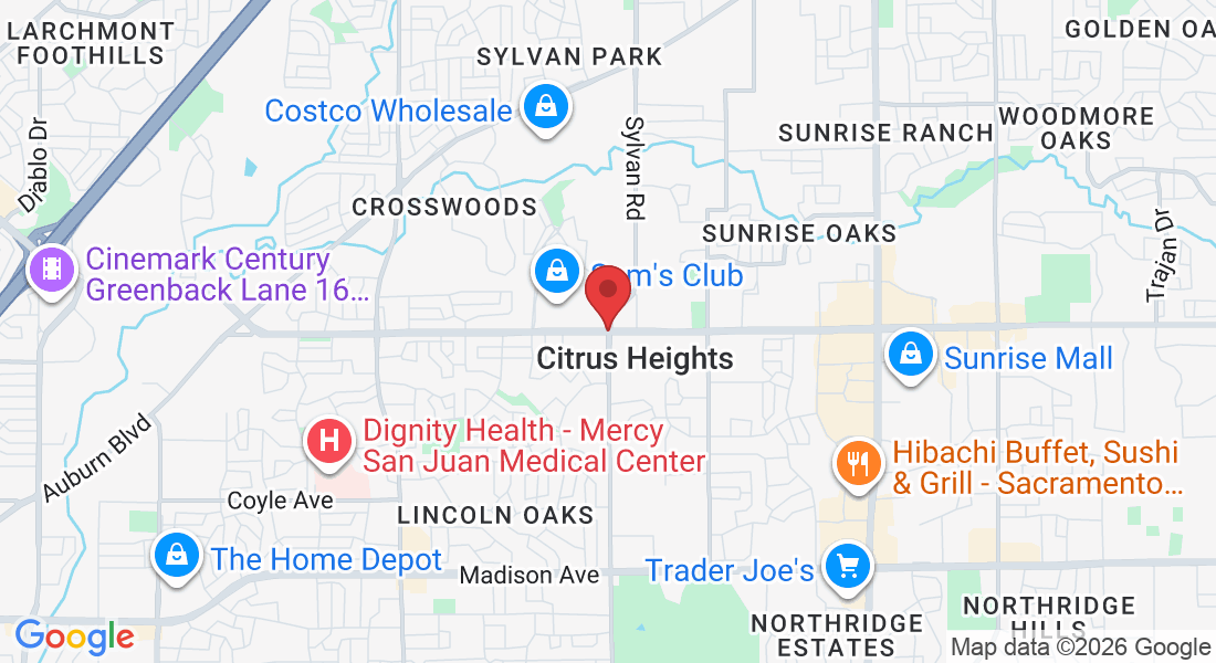 Citrus Heights, CA, USA