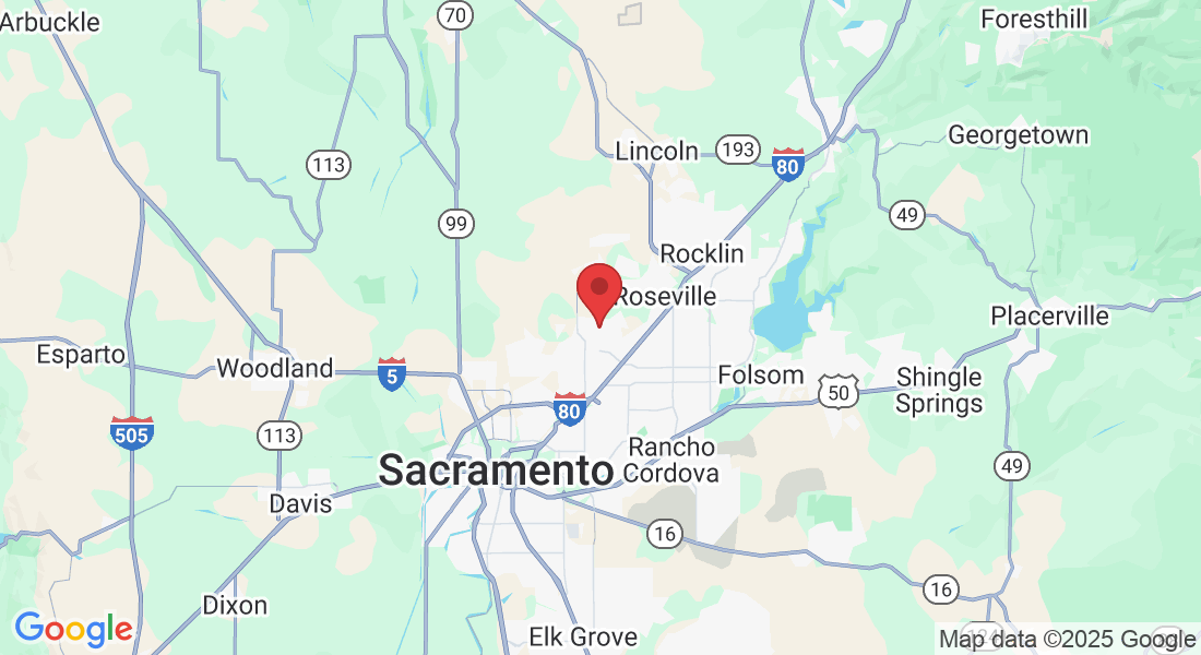 Antelope, CA, USA