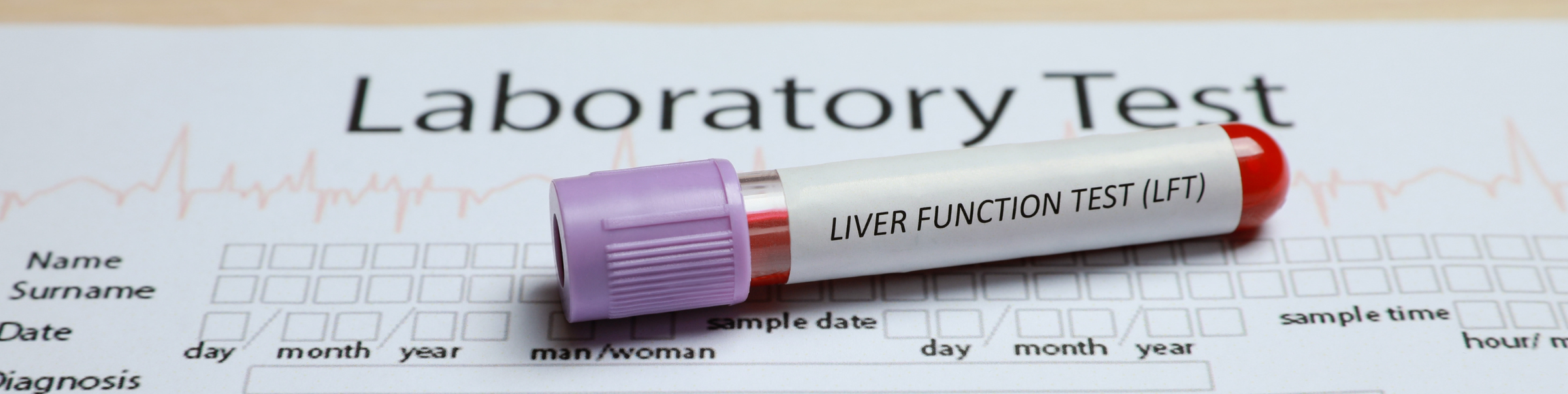 Common Lab Test Questions Answered