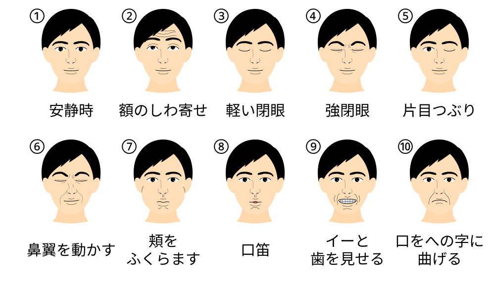 40点法･柳原法 (顔面神経麻痺)