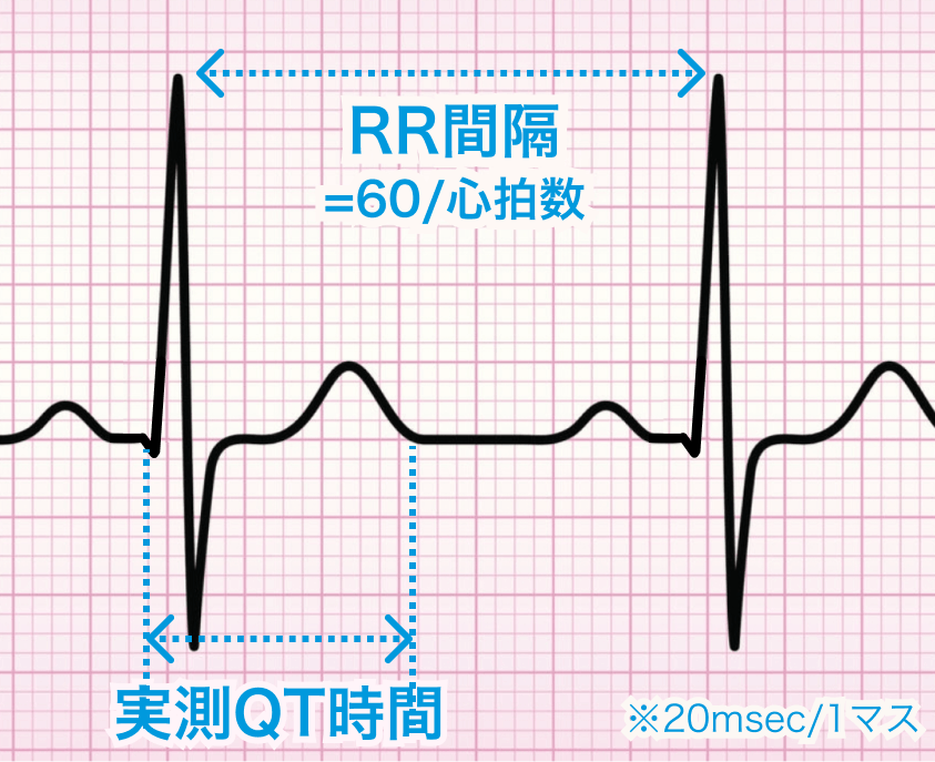 QTc (補正QT時間)