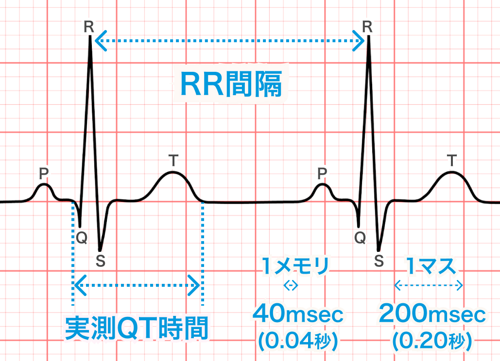 QT延長症候群 (LQTS)