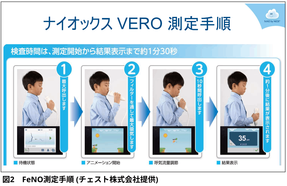 【特集：気管支喘息】気管支喘息診療における呼気中一酸化窒素濃度 (FeNO) 検査の使い方 (増永愛子先生)