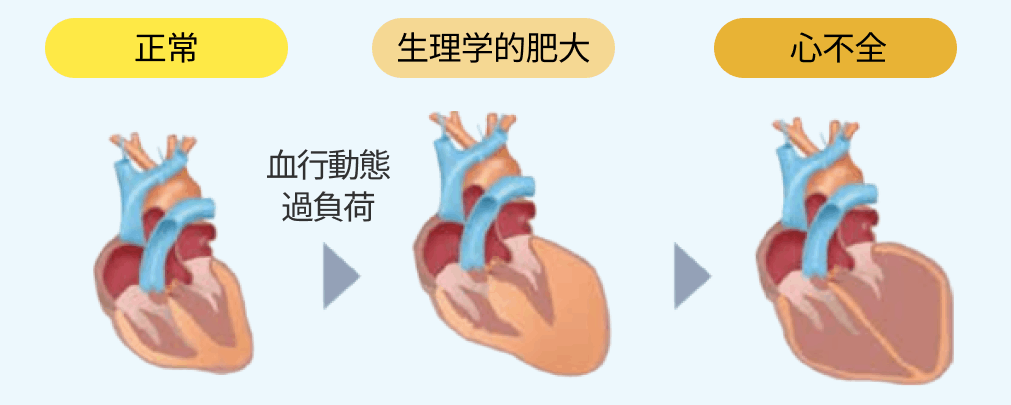 慢性心不全患者における「エンレスト®︎」という選択肢 ー2つの作用を有する単一の複合体ー