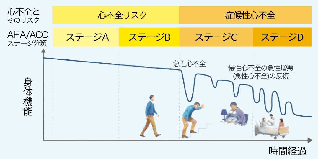 慢性心不全患者における「エンレスト®︎」という選択肢 ー2つの作用を有する単一の複合体ー