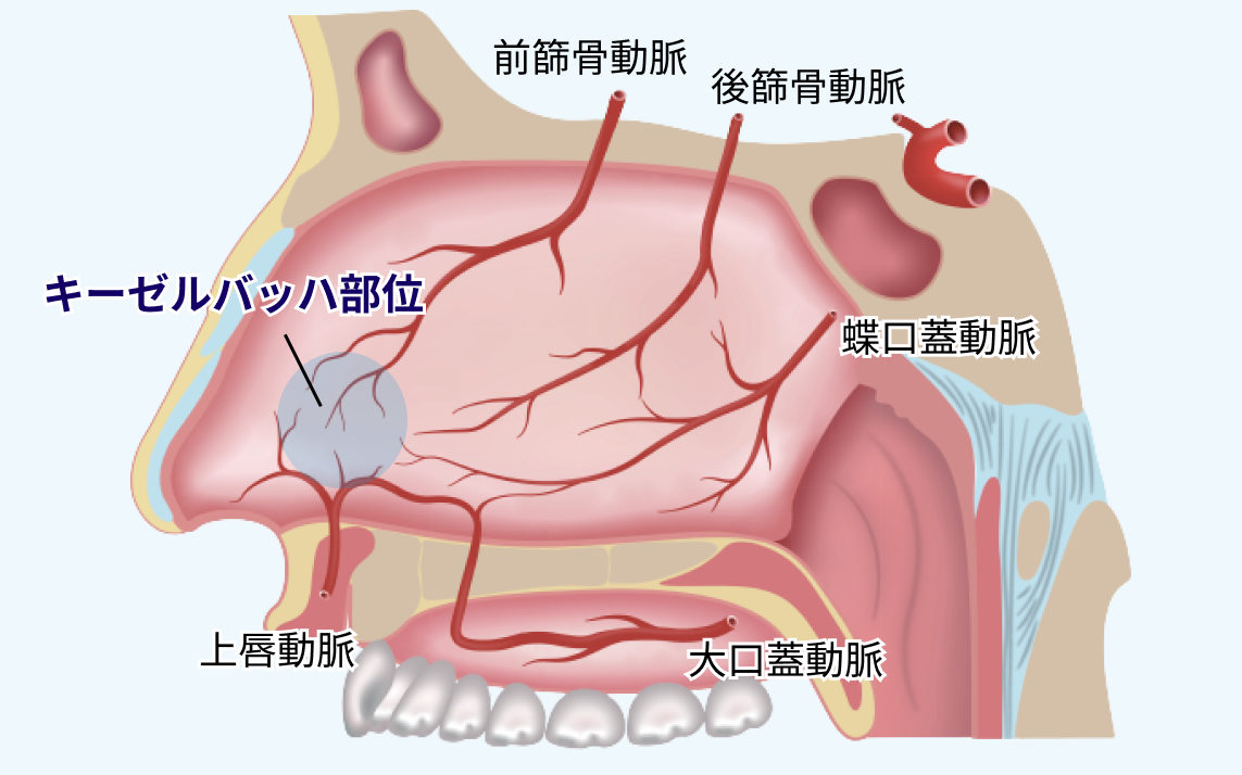 鼻出血