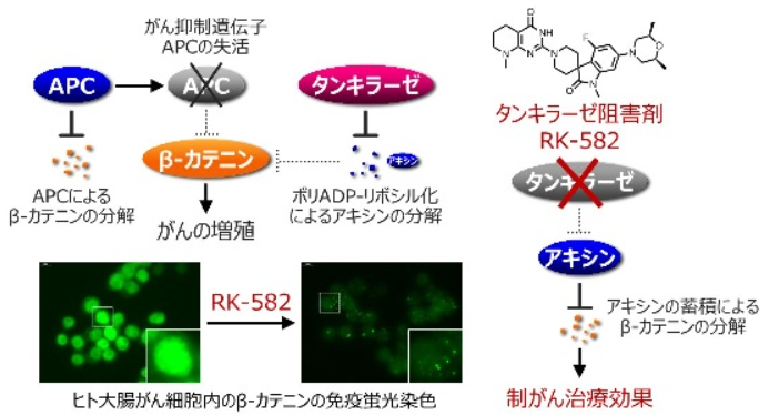 国内初､ 大腸癌へのタンキラーゼ阻害薬の医師主導第Ⅰ相治験を開始