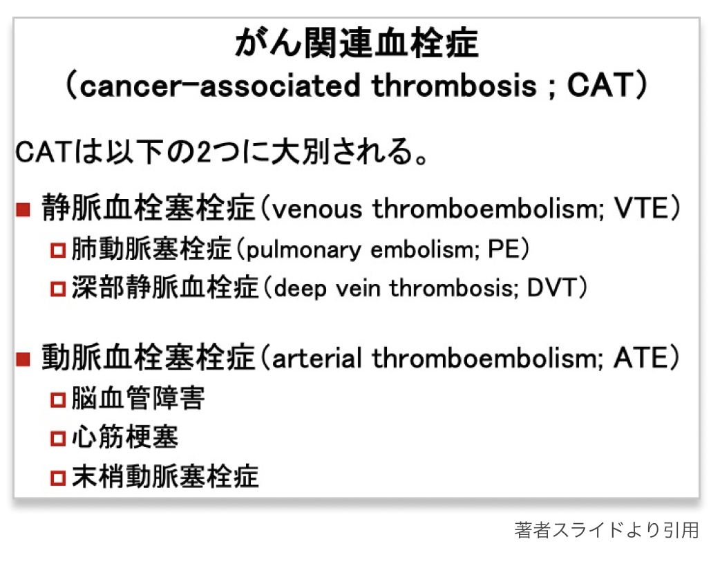 【新連載】まるわかり！がん関連静脈血栓塞栓症 (CA-VTE)