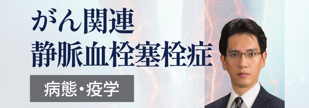 【新連載】まるわかり！がん関連静脈血栓塞栓症 (CA-VTE)