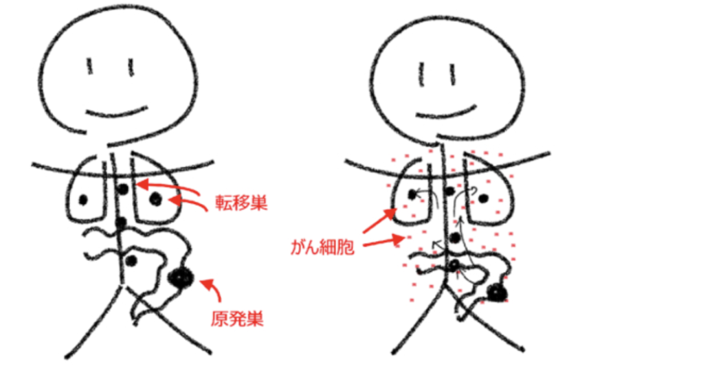 【人気連載】｢がん診療の羅針盤｣シリーズまとめ 