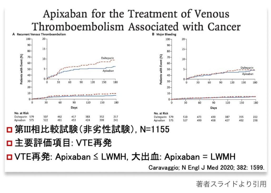 【連載】CA-VTEの治療 : DOACのエビデンス