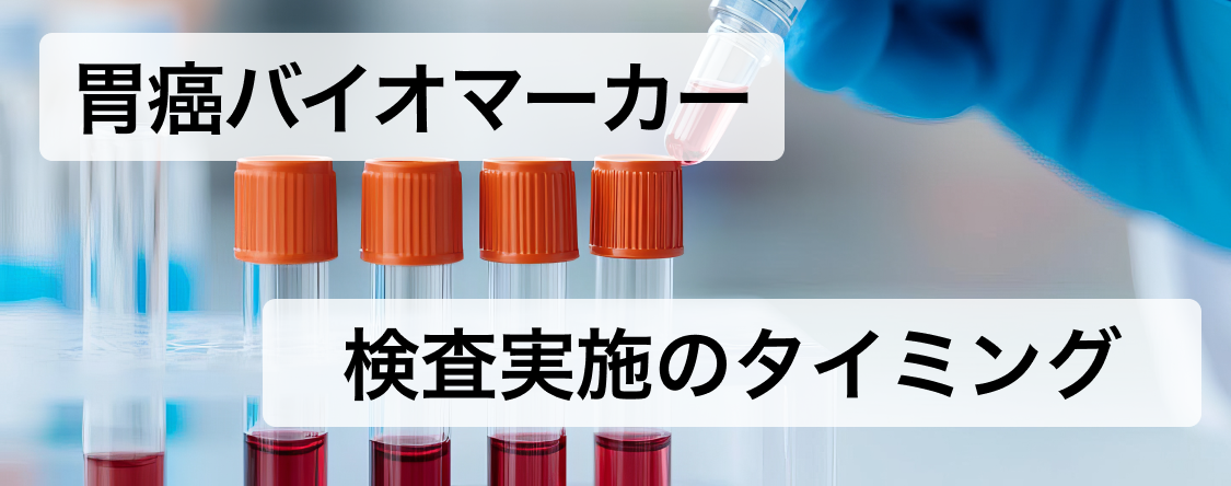 切除不能進行･再発胃癌　バイオマーカー検査を実施するタイミングは？