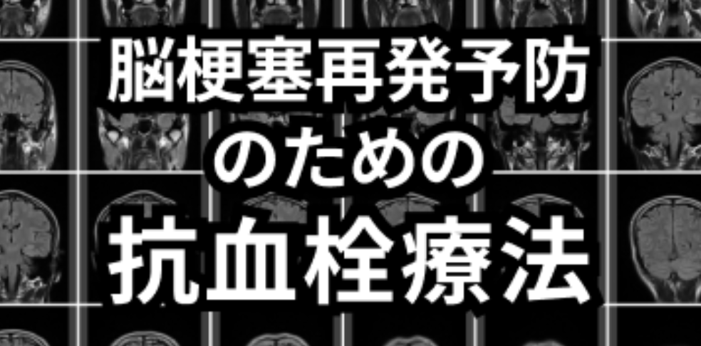 【最新治療がわかる！】脳梗塞人気コンテンツまとめ (計算ツール､専門医解説 他)