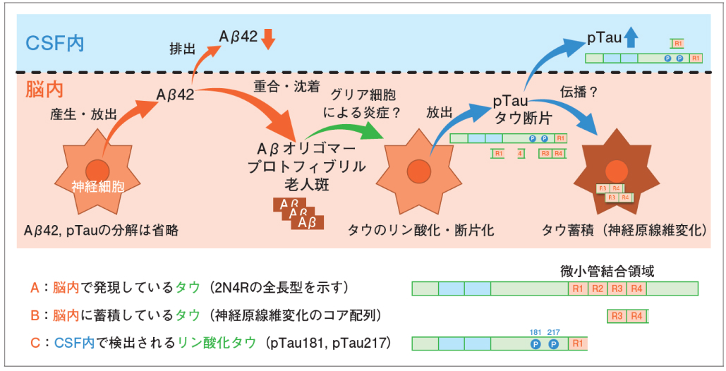 【注目記事まとめ】アルツハイマー病  (カレントテラピー)