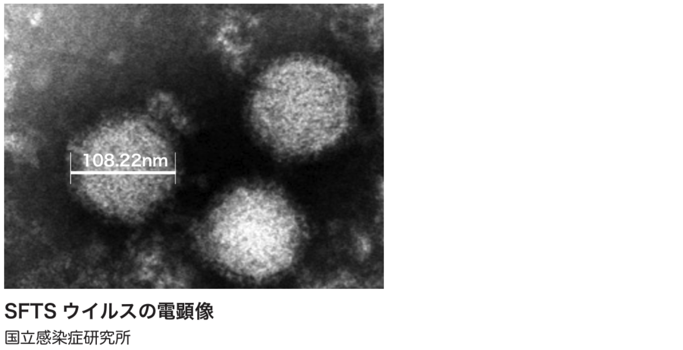 重症熱性血小板減少症候群 (SFTS) 診療の手引き2024年版､ 公開