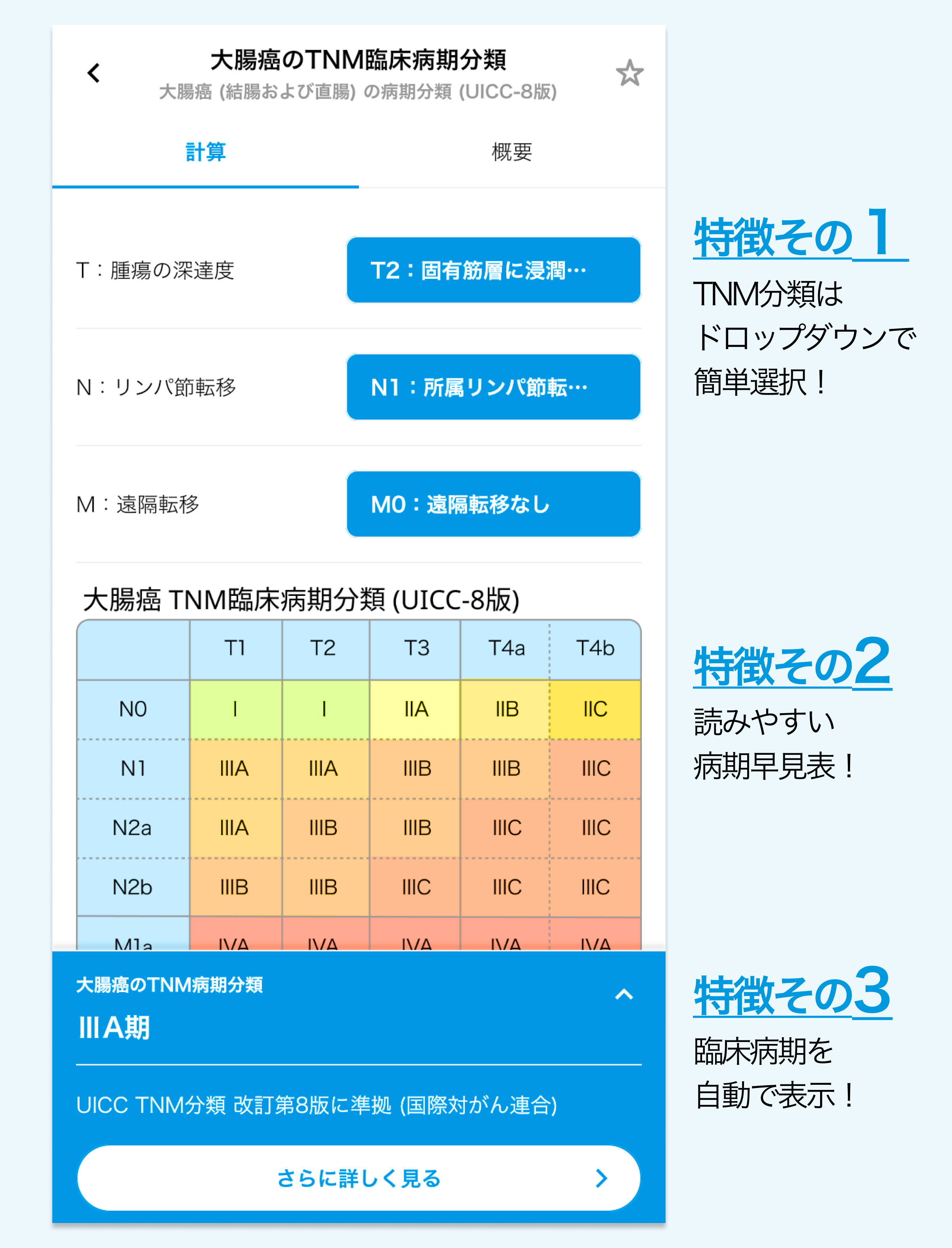 【大腸癌 TNM分類】ツールを追加！UICC版と癌取扱い規約の違いも一目で確認