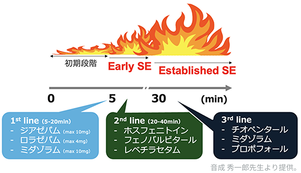 【新連載】音成 秀一郎先生による ｢けいれん診療ガイド｣ (随時更新中)