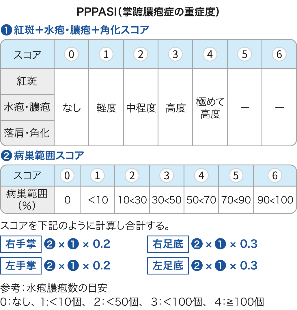 【掌蹠膿疱症】PPPASI が計算ツールに追加！