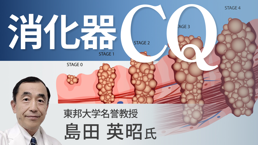 【胃癌アンケート】CPS 5以上かつCLDN18.2陽性進行胃癌の1次治療の選択は？(再調査)