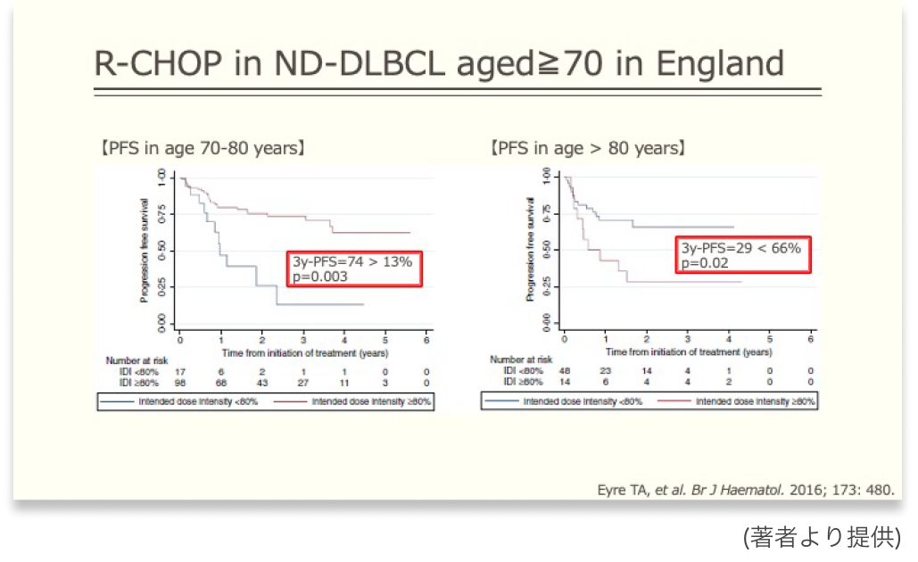 【疑問】80歳超の初発DLBCL､ 治療は何を選ぶ？
