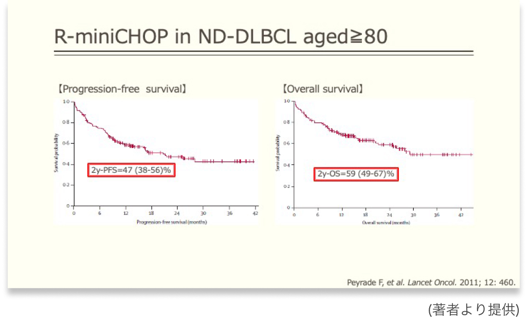 【疑問】80歳超の初発DLBCL､ 治療は何を選ぶ？