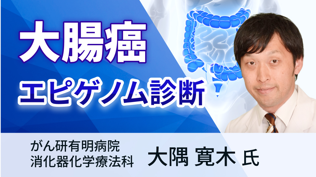 【専門医解説】エピゲノム診断で深化する、大腸癌の個別化医療