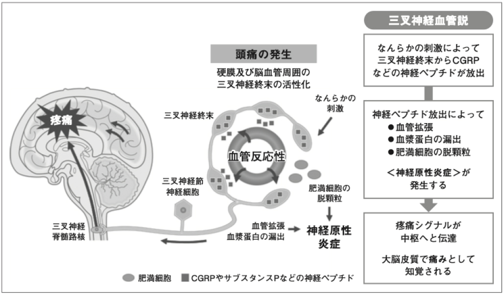 【注目記事まとめ】頭痛  (カレントテラピー)