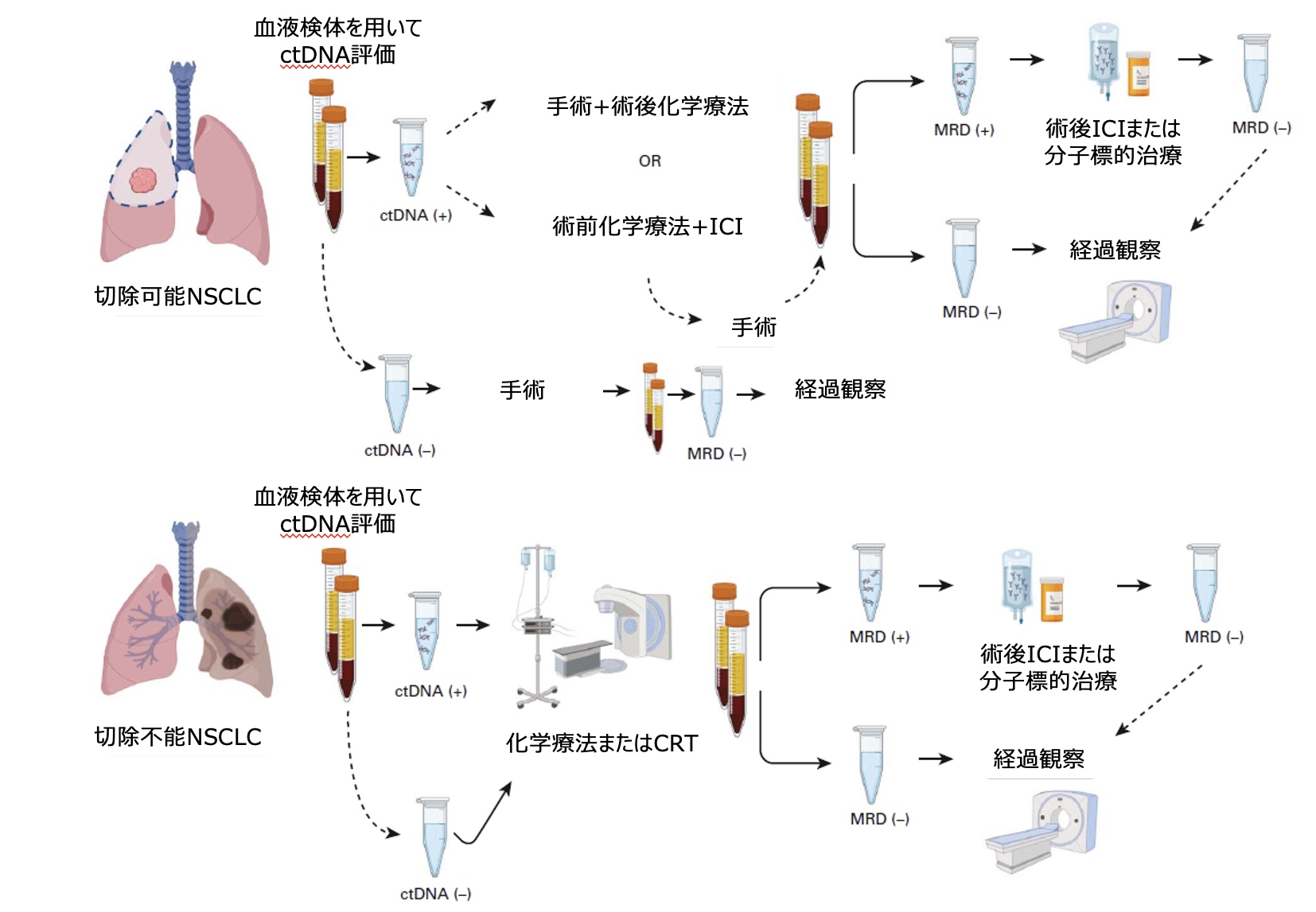 【注目キーワード】 微小残存病変 (MRD)とは？