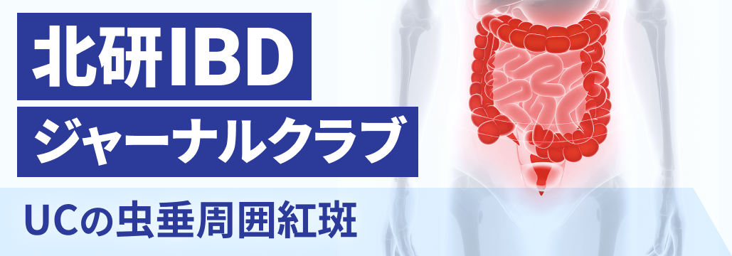 【解説】UCの虫垂周囲紅斑､ 予後に影響する？