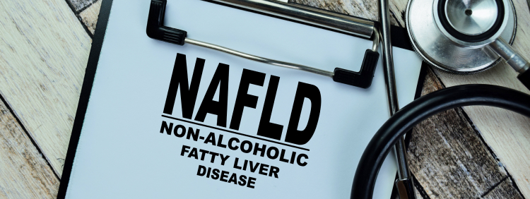 【J Hepatol】非アルコール性脂肪肝疾患の新名称が「MASLD」に決定