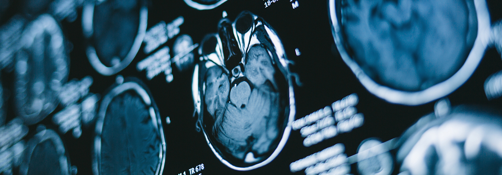 【Lancet Neurol】再発性多発性硬化症に対する｢新世代BTK阻害薬｣の有効性 (FENopta)