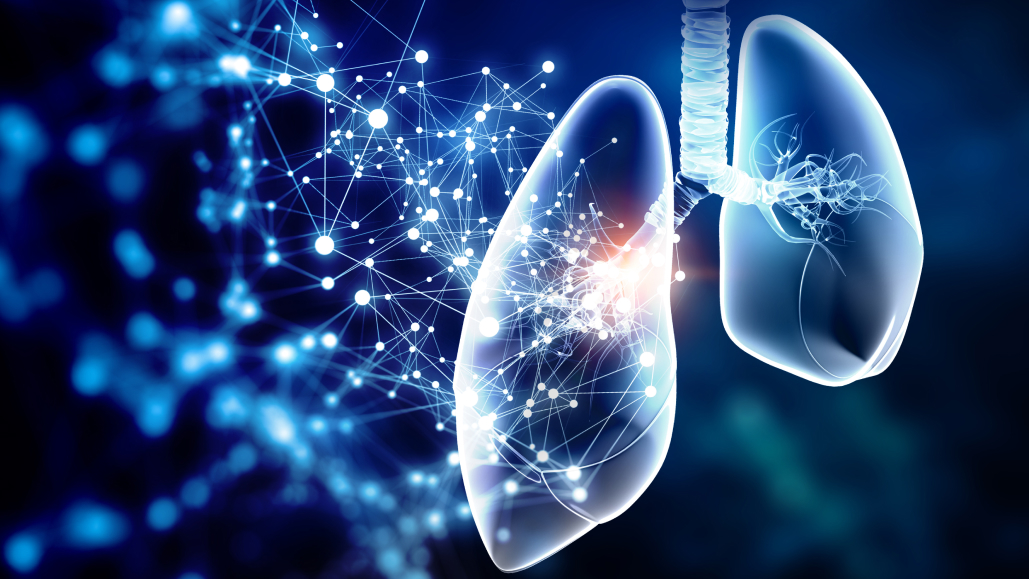 【NEJM】EGFR陽性NSCLCの1次治療 : Ami＋LazがOsi単剤よりOS改善