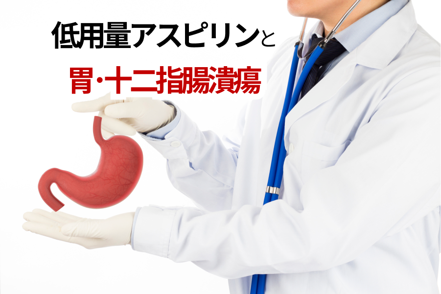 【論文】低用量アスピリンの新規使用は胃･十二指腸潰瘍の発症リスクと相関