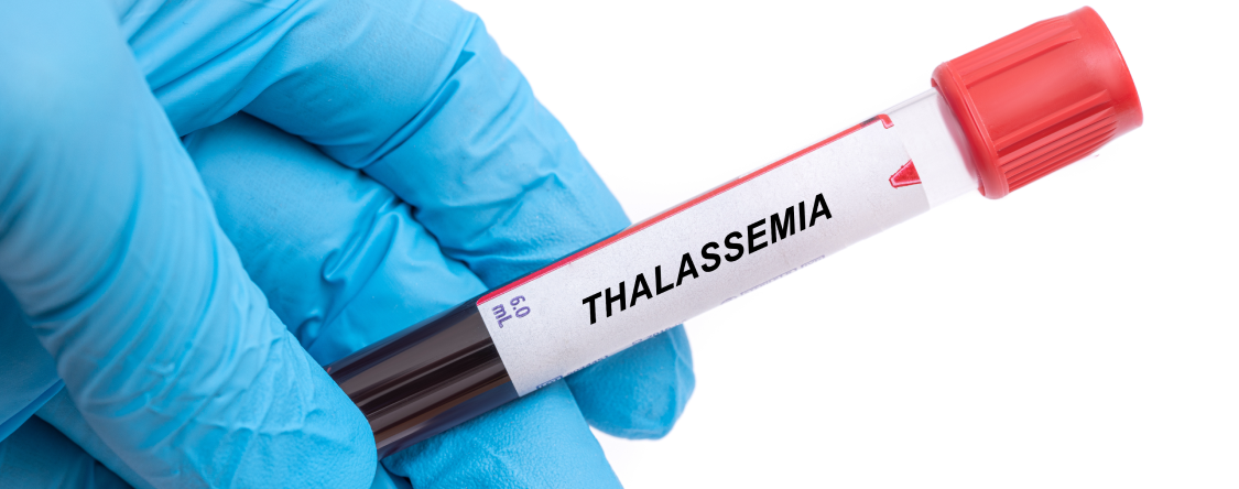 【Lancet Haematol】輸血依存性βサラセミア､ルスパテルセプトの長期有効性を検証