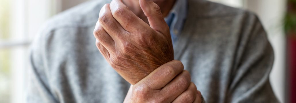 【Lancet Rheumatol】ICI後の関節炎・関節痛に3つの炎症パターン