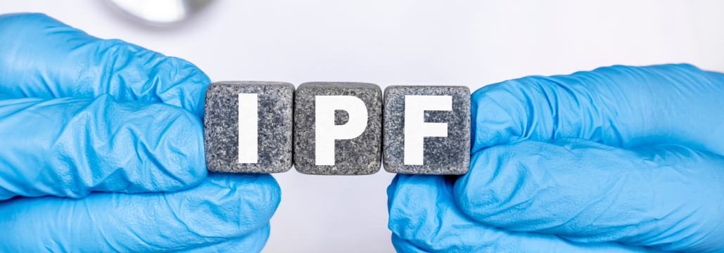 【JAMA】IPFに伴う慢性咳嗽へのナルブフィン徐放錠､ 6週で咳嗽頻度低下