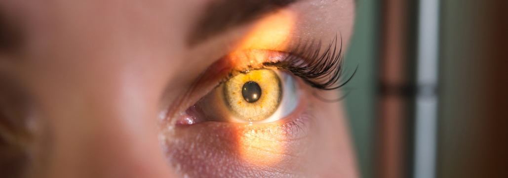 【NEJM】網膜中心動脈閉塞症へのtenecteplase､ 視力改善せず