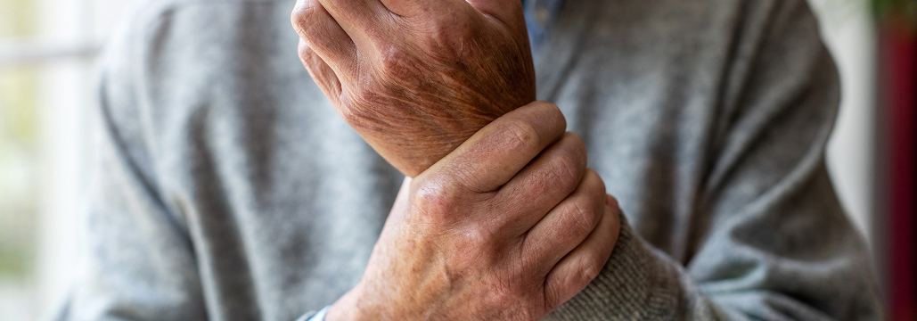 【Lancet Rhumatol】アバタセプト1年投与､ RA発症を最大4年遅延