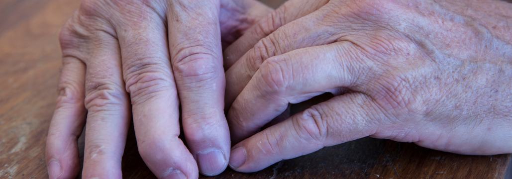 【Rheumatology】乾癬性関節炎へのビメキズマブ､ 3年後も高い有効性と安全性