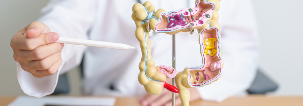 【潰瘍性大腸炎】ステロイド抵抗性UCにタクロリムスは有用か？
