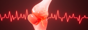 【Rheumatology】RA寛解期におけるbDMARD減量､ 非劣性示せず―予測モデル開発
