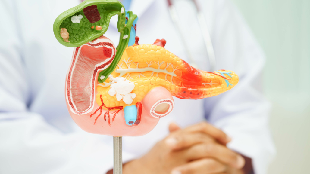 【Cancers】切除可能な膵管腺癌でNAC-GSが長期生存を改善 : 岡山大の265例解析