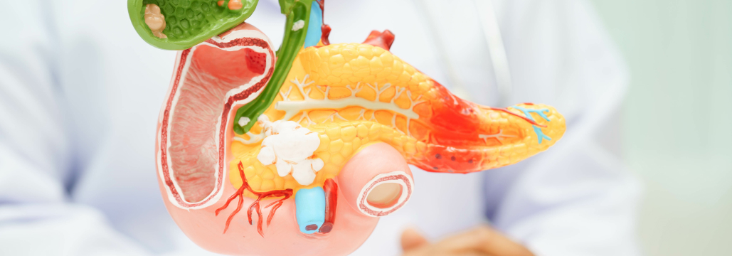 【Cancers】切除可能な膵管腺癌でNAC-GSが長期生存を改善 : 岡山大の265例解析