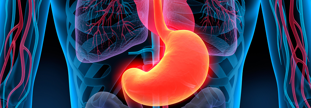 【Cell Rep Med】EGJ癌の至適郭清範囲､ 全国前向き研究の最終結果