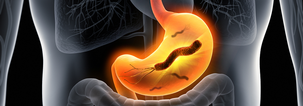 【Gastroenterology】ピロリ除菌､ 耐性増で戦略見直しへ