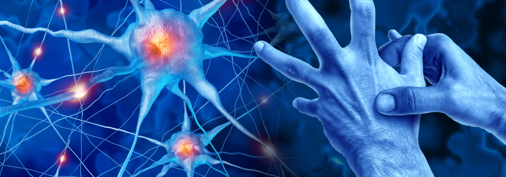 【Lancet】GLP-1受容体作動薬エキセナチド､ パーキンソン病の進行抑制できず